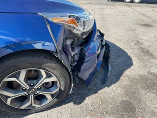 2021 Kia Forte LXS - Primary Damage Right Image