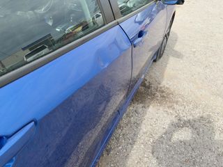 2018 Honda Civic EX - Primary Damage Right Image